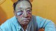 Violento episodio en Domínguez: investigan agresión a un hombre en un establecimiento de salud. Violento episodio en Domínguez: investigan agresión a un hombre en un establecimiento de salud.