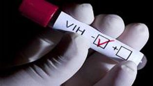 Descubren una molécula que destruye las células infectadas y podría ser el fin del HIV