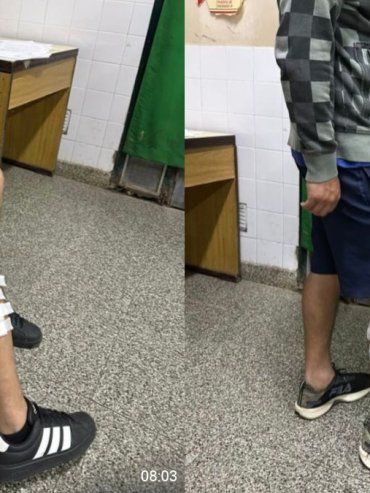 Ataque a tiros en Alto Verde: un delincuente intentó asaltar a dos hermanos y los hirió con una escopeta