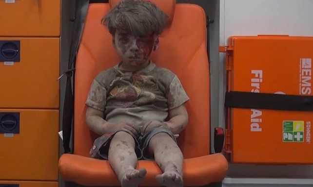 Otra tragedia golpeó a Omran, el nene sirio cuya foto se viralizó esta semana