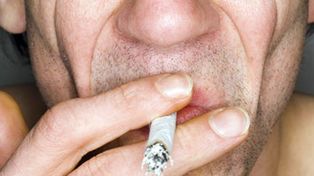 Fotos revelan cómo el cigarrillo envejece rostros de gemelos