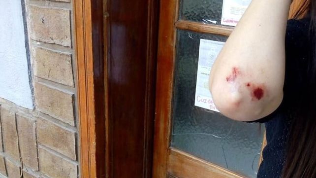 Paraná: una mujer atacó a una chica en la calle