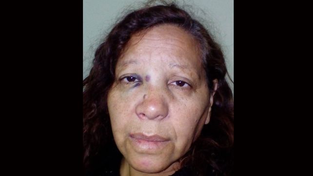 Una discusión entre vecinos terminó con una mujer salvajemente golpeada