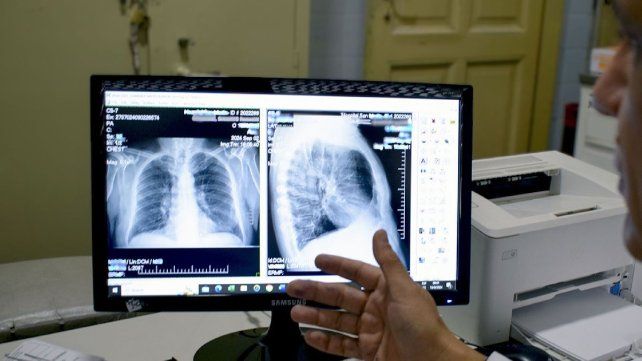Desde el Ministerio de Salud de Entre Ríos hablaron acerca de las afecciones respiratorias y la forma de evitar complicaciones.