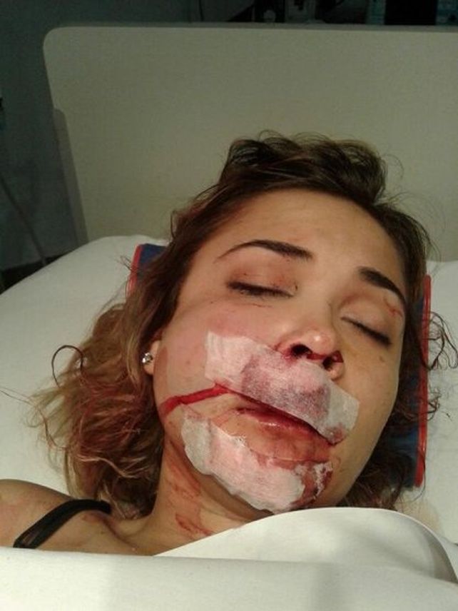 Así la dejó un grupo de patovicas tras una salvaje golpiza