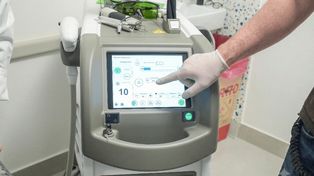 Nueva era en dermatología: tratamientos láser más seguros