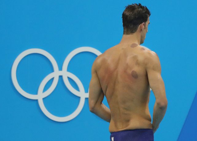 Phelps