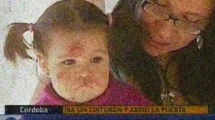 Imputan por lesiones culposas a la madre de la nena que cay&oacute; del auto
