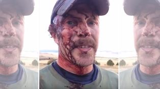 Así quedó un cazador tras ser atacado  por un oso