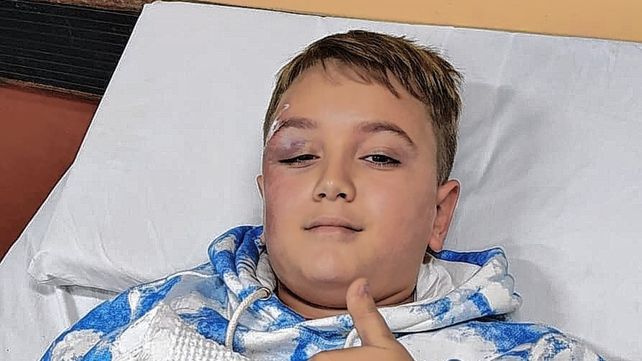 Atropellaron a un niño en la ciclovía de Vélez Sarsfield y Alem y el conductor se fugó: Verlo tirado en el asfalto fue devastador