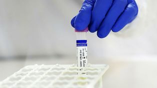 Coronavirus: Rosario reportó 80 contagios y 7 decesos en las últimas 24 horas