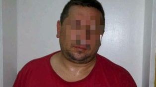Murió la niña que recibió una bala perdida 