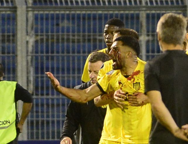 El proyectil del escándalo. El marcador lateral izquierdo de Peñarol