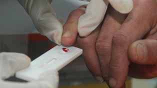 Con los test del Cipress, podrán detectar el VIH en 20 minutos