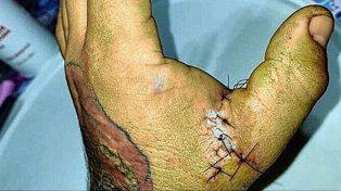 Atacó con un cuchillo al hombre que tatuó a su hija sin su consentimiento