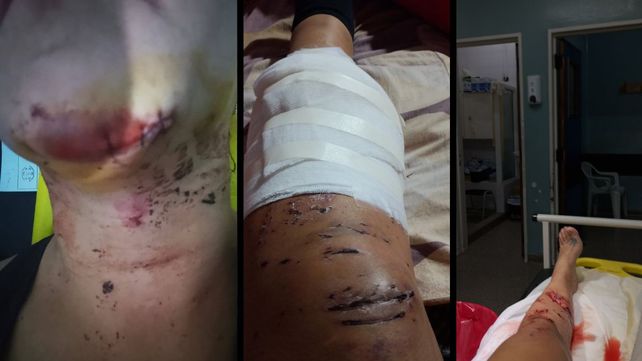 Otro caso de atropello y fuga en Santa Fe: denuncian que un auto en contramano los embistió y buscan al conductor Otro caso de atropello y fuga en Santa Fe: denuncian que un auto en contramano los embistió y buscan al conductor