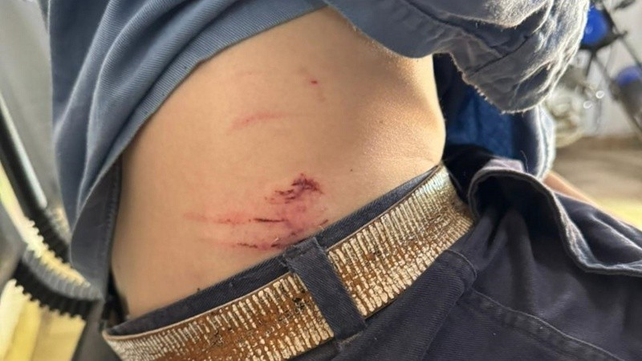 Un operario de la EPE fue atacado por una jauría, entre ellos dos perros de raza pitbull, y sufrió múltiples heridas