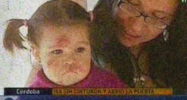 Imputan por lesiones culposas a la madre de la nena que cay&oacute; del auto