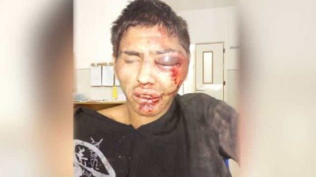 Vuelven a detener a joven que intentó robar un celular y fue golpeado por vecinos