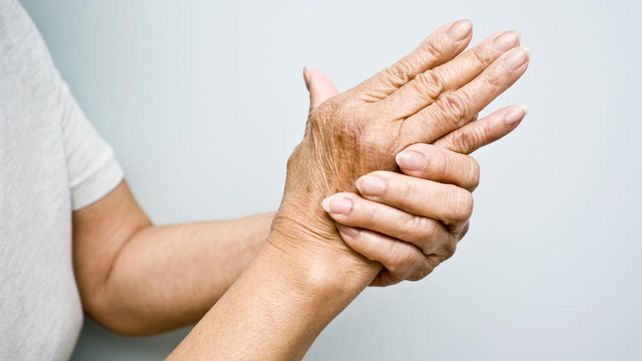 Personas con artritis reumatoidea