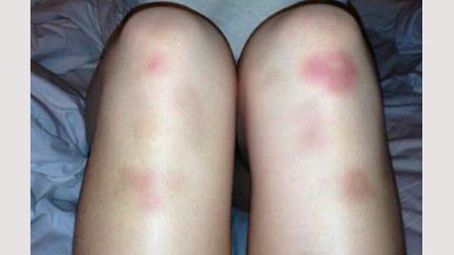 Joven denunció a su novio policía, por violento