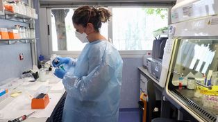 Viruela del mono: confirman el tercer caso en el país, el primero sin antecedentes de viaje