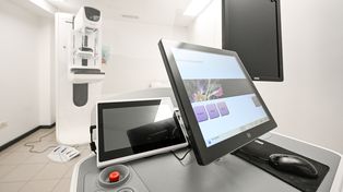 Mamógrafo Hologic Selenia Dimensions con su workstation