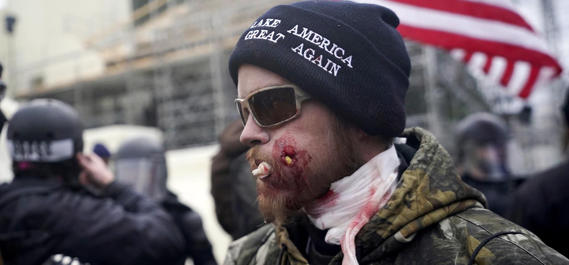 Un partidario del entonces presidente Donald Trump resulta herido en la cara durante los enfrentamientos con la policía en el Capitolio de Estados Unidos, el 6 de enero de 2021, en Washington.