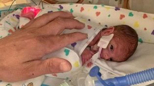 Hazaña médica: dieron de alta a un bebé que nació con menos de medio kilo
