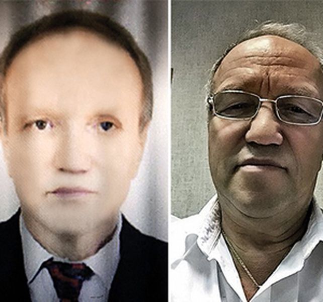 Gendler siempre fue un hombre de tez pálida. Ahora asegura que si piel se está oscureciendo.