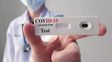 la anmat autorizo el uso del quinto autotest de coronavirus