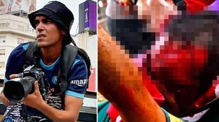 Pablo Grillo, el fotógrafo herido por una cápsula de gas lacrimógeno durante la represión de la marcha de jubilados permanece internado en estado crítico.&nbsp;