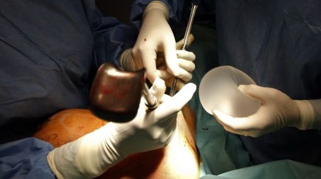 La ley indica que las medicinas prepagas deben cubrir la cirugía reconstructiva tras una mastectomía por patología mamaria y la provisión de las prótesis necesarias.
