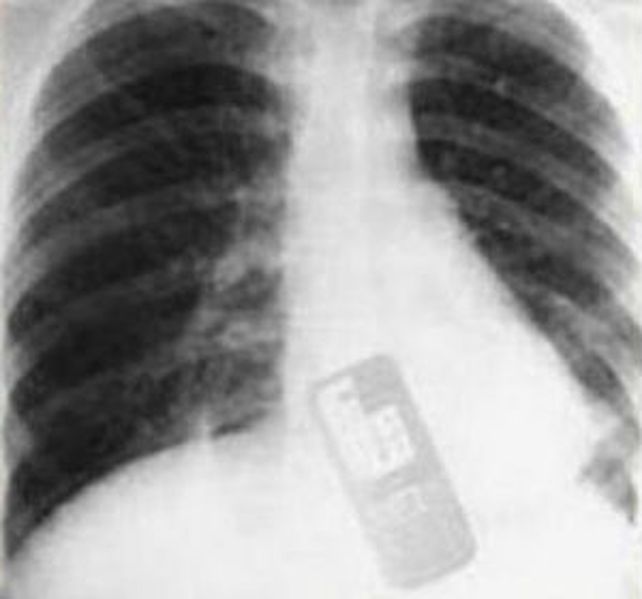 Imagen de la joven ingresada en el hospital.
