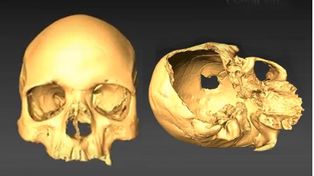 Científicos resolvieron el asesinato de un hombre cometido hace unos 5.000 años