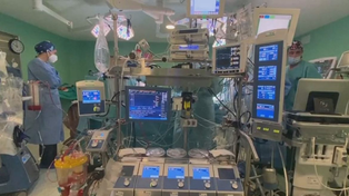 Una máquina de circulación extracorpórea, que permite las cirugías de corazón abierto.&nbsp;