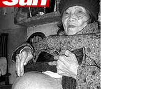 Una mujer china de 92 a&ntilde;os lleva un feto en su vientre desde hace 60 a&ntilde;os