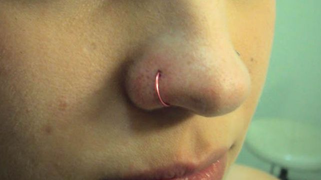Se puso un piercing en la nariz y permanece internada por una grave infección