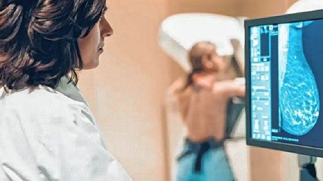 El cáncer de mama afecta a una de cada ocho mujeres y la detección temprana es fundamental