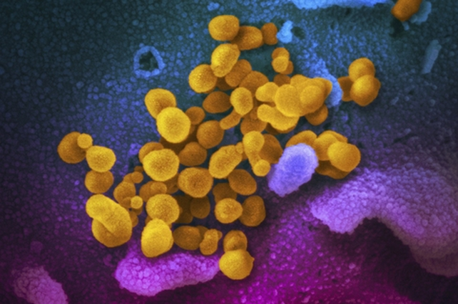 Una de las primeras imágenes claras del coronavirus del Covid