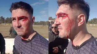 El árbitro fue golpeado en pleno campo de juego y debió ser derivado a un hospital.
