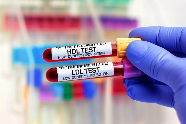 Colesterol alto: por qué se puede tener aún con peso saludable y ejercicio