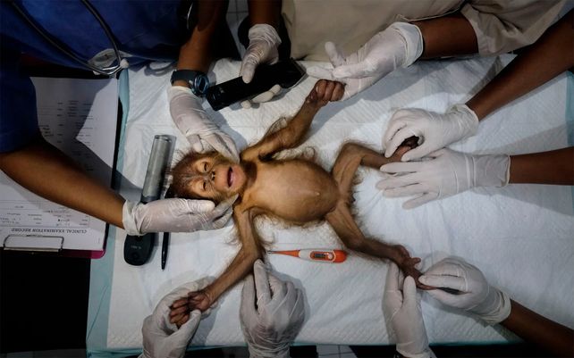 Los orangutanes en Indonesia están amenazados por el avasallamiento continuo de la selva tropical. La foto muestra a un equipo de rescatistas preparando a Brenda, una orangután hembra que se estima que tiene tres meses ya que todavía no tiene dientes, para la cirugía.