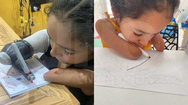 Solidaridad: Trini recibió un dispositivo que le permite comer y dibujar con autonomía