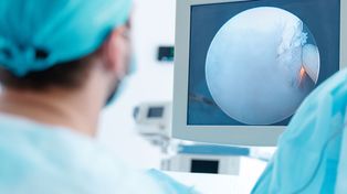 Cáncer de próstata: la clave de la detección temprana y el tratamiento personalizado