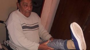 Fallo judicial exige a Iapos entregar una prótesis