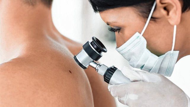 Inicia la Campaña de Prevención del Cáncer de Piel
