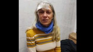 Betina Baleani. La esposa del edil peronista Marcelo Remondino fue atacada junto al legislador por una patota.
