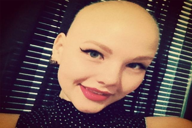 Una modelo con cáncer se muestra sin pelo en sus campañas