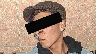 La Matanza: le clavaron una llave en la cara durante una pelea por una mujer